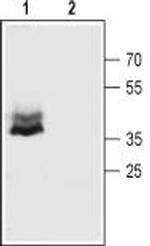 Connexin-43 Antibody in Western Blot (WB)