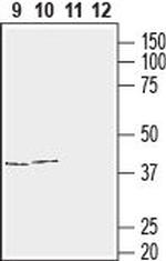 Connexin-43 Antibody in Western Blot (WB)