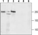 CaV1.3 (CACNA1D) (extracellular) Antibody in Western Blot (WB)