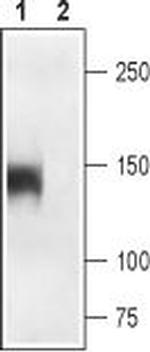 CaV1.1 (CACNA1S) (extracellular) Antibody in Western Blot (WB)