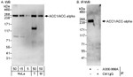 ACC1/ACC-alpha Antibody in Western Blot (WB)