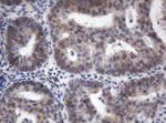 ACD Antibody in Immunohistochemistry (Paraffin) (IHC (P))