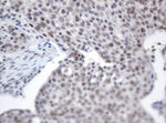 ACD Antibody in Immunohistochemistry (Paraffin) (IHC (P))