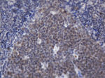 ACD Antibody in Immunohistochemistry (Paraffin) (IHC (P))