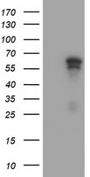 ACD Antibody in Western Blot (WB)