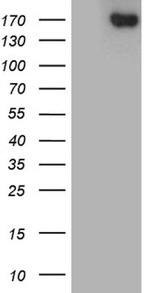 ACE Antibody in Western Blot (WB)