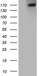 ACE Antibody in Western Blot (WB)