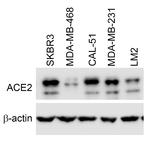 ACE2 Antibody in Western Blot (WB)