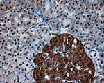 ACLY Antibody in Immunohistochemistry (Paraffin) (IHC (P))