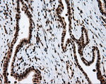 ACLY Antibody in Immunohistochemistry (Paraffin) (IHC (P))