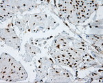 ACLY Antibody in Immunohistochemistry (Paraffin) (IHC (P))