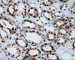 ACLY Antibody in Immunohistochemistry (Paraffin) (IHC (P))