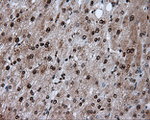 ACLY Antibody in Immunohistochemistry (Paraffin) (IHC (P))