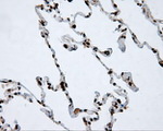 ACLY Antibody in Immunohistochemistry (Paraffin) (IHC (P))