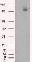 ACLY Antibody in Western Blot (WB)