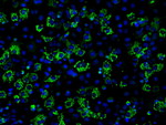 ACO2 Antibody in Immunocytochemistry (ICC/IF)