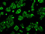 ACO2 Antibody in Immunocytochemistry (ICC/IF)