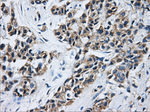 ACO2 Antibody in Immunohistochemistry (Paraffin) (IHC (P))