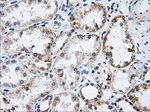 ACO2 Antibody in Immunohistochemistry (Paraffin) (IHC (P))