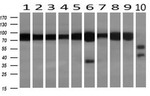 ACO2 Antibody in Western Blot (WB)