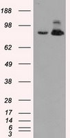 ACO2 Antibody in Western Blot (WB)