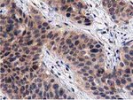 ACOT12 Antibody in Immunohistochemistry (Paraffin) (IHC (P))