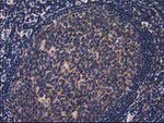 ACOT12 Antibody in Immunohistochemistry (Paraffin) (IHC (P))