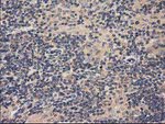 ACOT12 Antibody in Immunohistochemistry (Paraffin) (IHC (P))