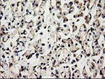 ACOT12 Antibody in Immunohistochemistry (Paraffin) (IHC (P))