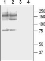 PMCA2 Antibody in Western Blot (WB)