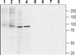 SERCA2 Antibody in Western Blot (WB)