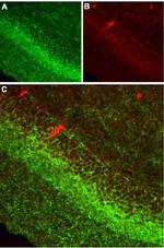 Cannabinoid Receptor 1 (extracellular) Antibody in Immunohistochemistry (IHC)