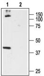 Cannabinoid Receptor 1 (extracellular) Antibody in Western Blot (WB)