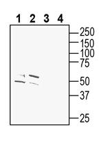 Cannabinoid Receptor 1 (extracellular) Antibody in Western Blot (WB)