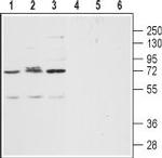 CXCR2 (extracellular) Antibody in Western Blot (WB)