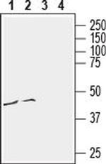 CCR3 (extracellular) Antibody in Western Blot (WB)