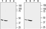 CCR9 (extracellular) Antibody in Western Blot (WB)