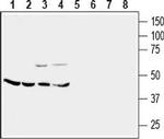 CRF2/CRHR2 (extracellular) Antibody in Western Blot (WB)