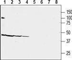 CRF2/CRHR2 (extracellular) Antibody in Western Blot (WB)