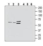 CX3CR1 (extracellular) Antibody in Western Blot (WB)