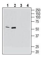 CX3CR1 (extracellular) Antibody in Western Blot (WB)