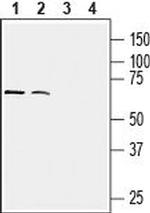 CX3CR1 (extracellular) Antibody in Western Blot (WB)