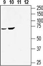 GPR55 (extracellular) Antibody in Western Blot (WB)