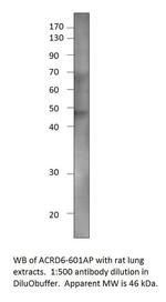 Atypical Chemokine Receptor D6 Antibody in Western Blot (WB)