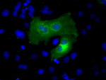 ACSBG1 Antibody in Immunocytochemistry (ICC/IF)