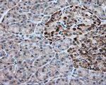 ACSBG1 Antibody in Immunohistochemistry (Paraffin) (IHC (P))