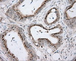 ACSBG1 Antibody in Immunohistochemistry (Paraffin) (IHC (P))