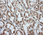 ACSBG1 Antibody in Immunohistochemistry (Paraffin) (IHC (P))