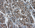 ACSBG1 Antibody in Immunohistochemistry (Paraffin) (IHC (P))