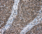 ACSBG1 Antibody in Immunohistochemistry (Paraffin) (IHC (P))